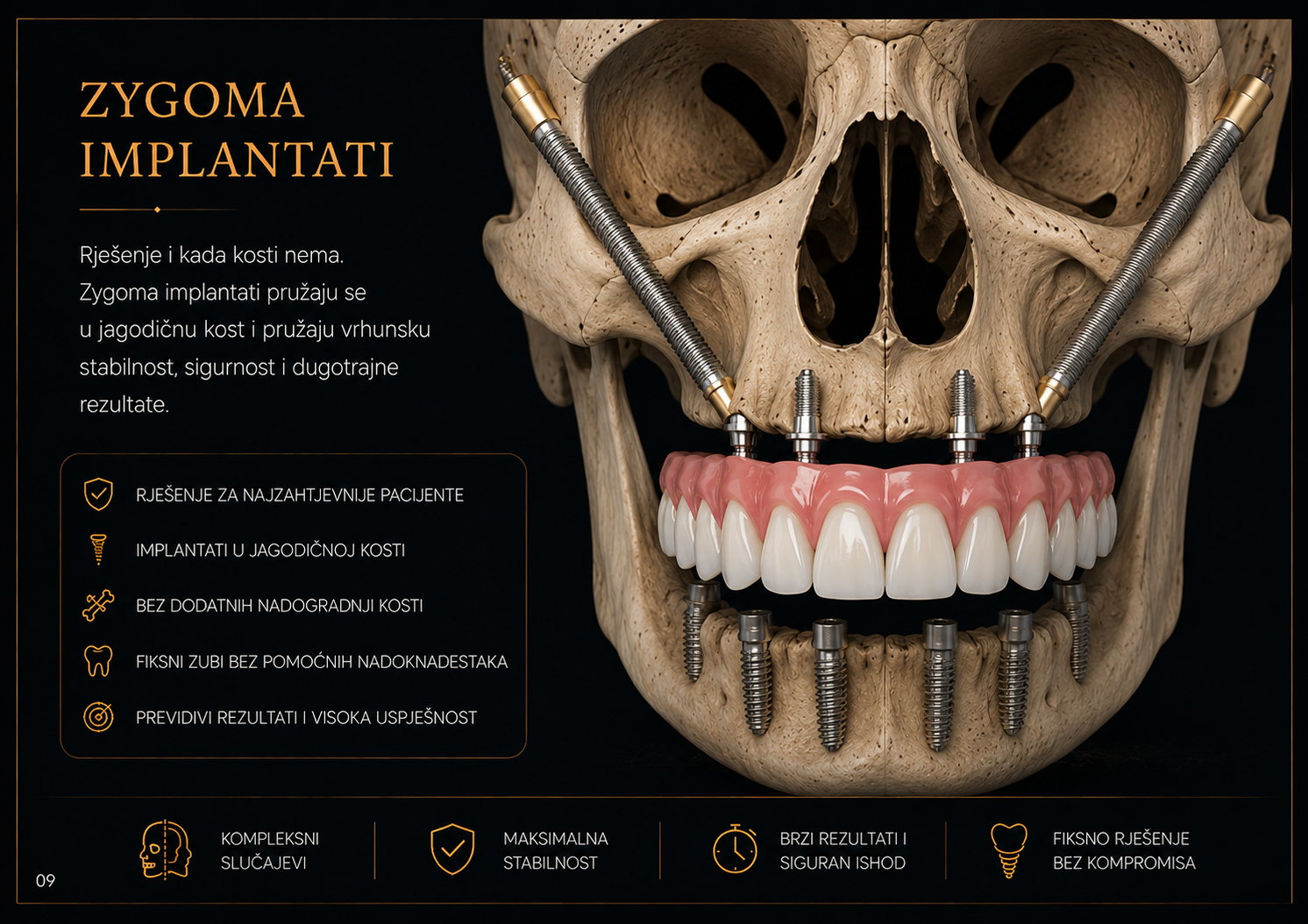 Zygoma implantati ugradnja u Implantološkom centru Smile