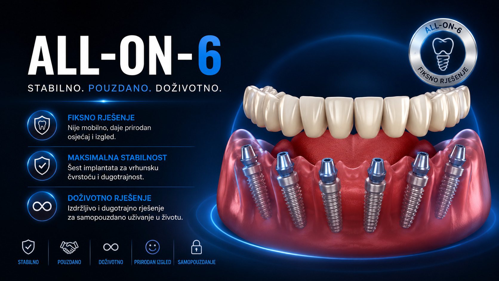 All-on-6 fiksni zubi Smile Bjelovar