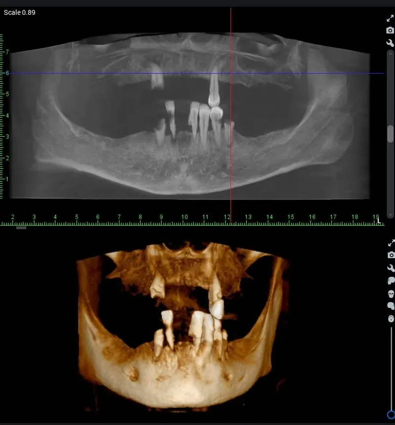 CBCT 3D snimka