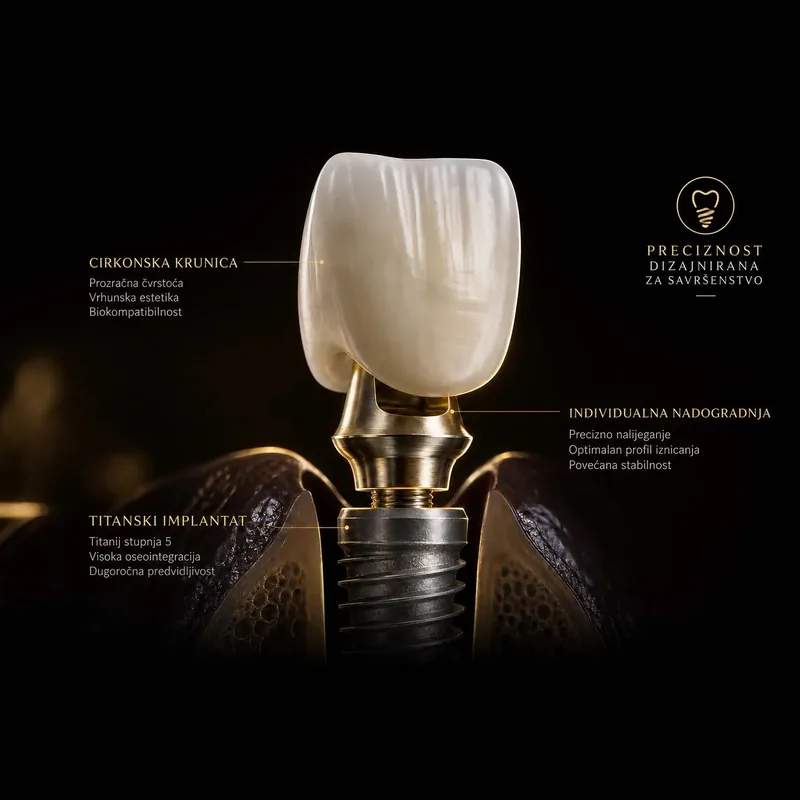 Megagen AnyOne implantati i CAD/CAM tehnologija