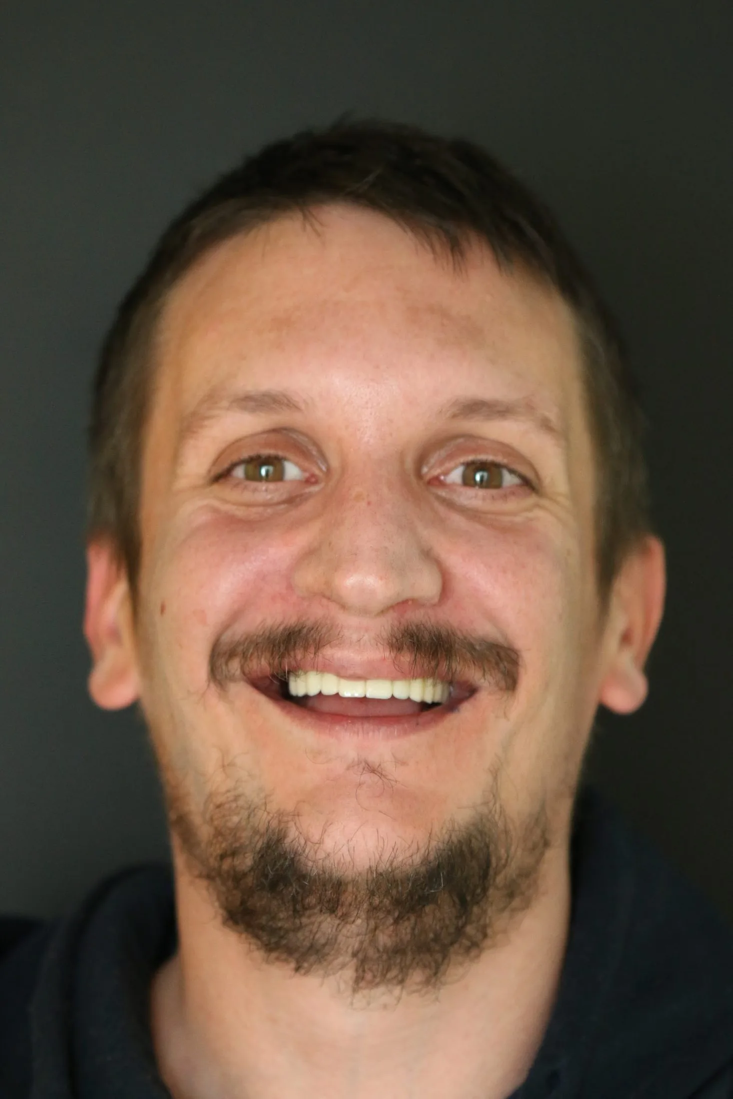 Slučaj 11 — poslije zahvata
