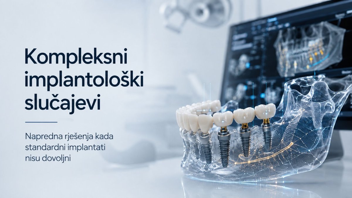 Kompleksni implantološki slučajevi