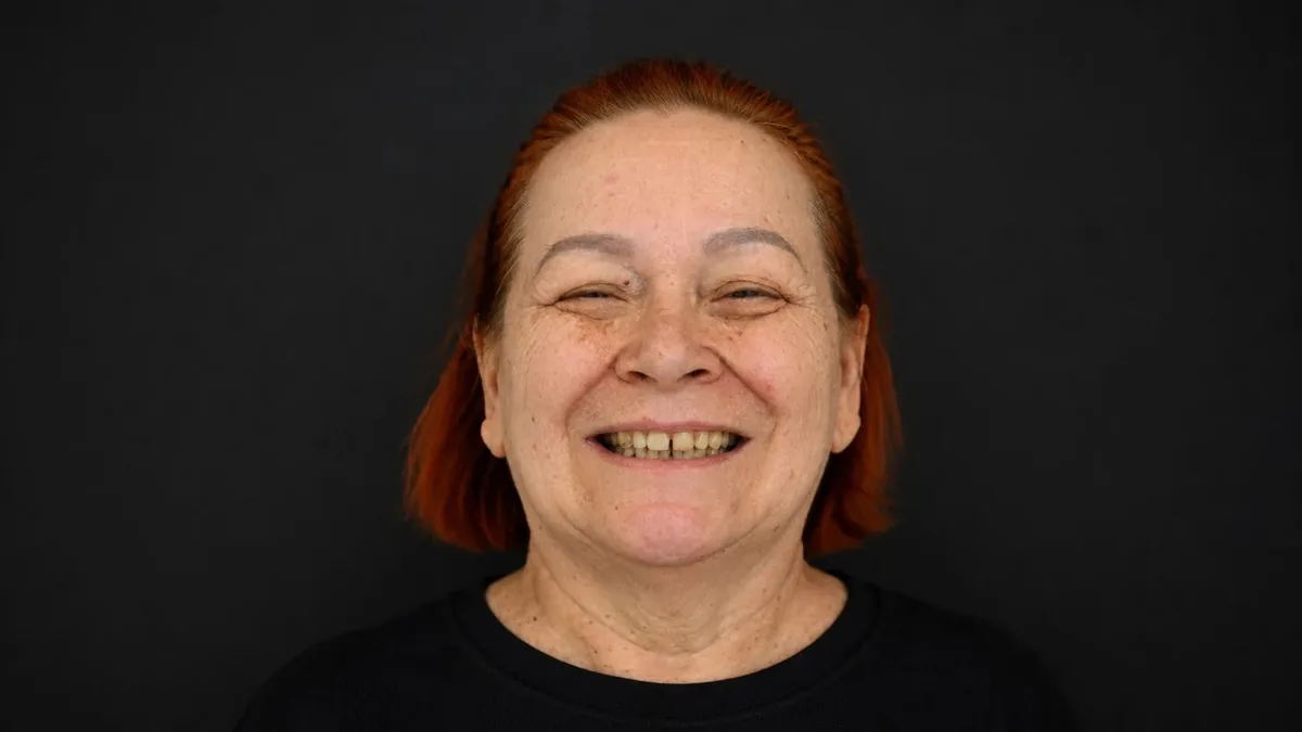 Osmijeh prije