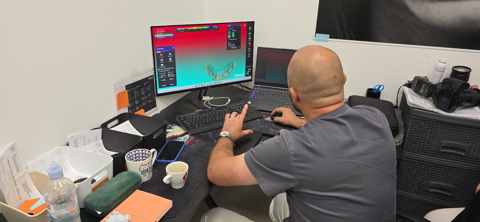 3D Smile lab — vlastiti 3D dentalni laboratorij Implantološkog centra Smile